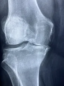 X-ray photograph