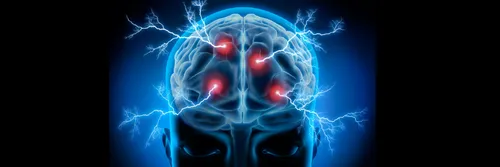 An abstract illustration of a brain with electrical activity