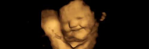 4-D ultrasound scan of a baby showing a laugh face reaction