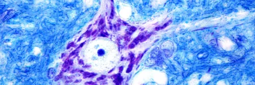 Spiral motor neuron