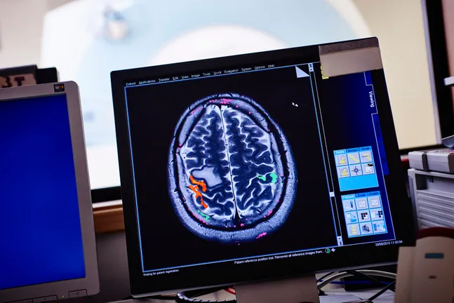 A compuer monitor displaying brain data in fMRI control room