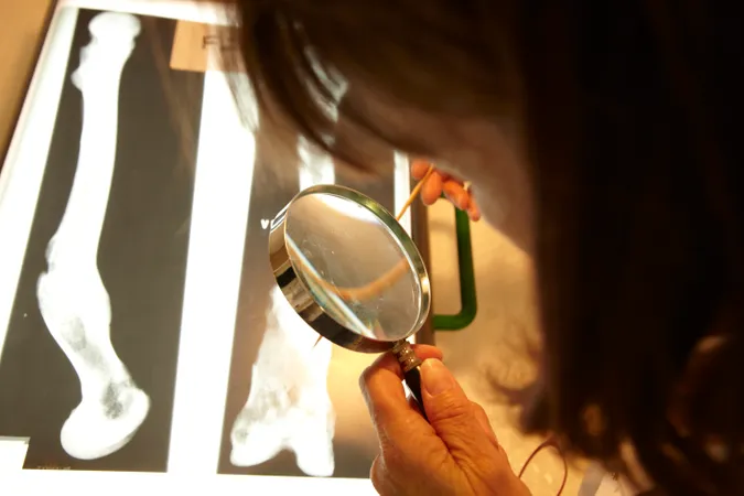 Someone inspecting a bone with a magnifying glass