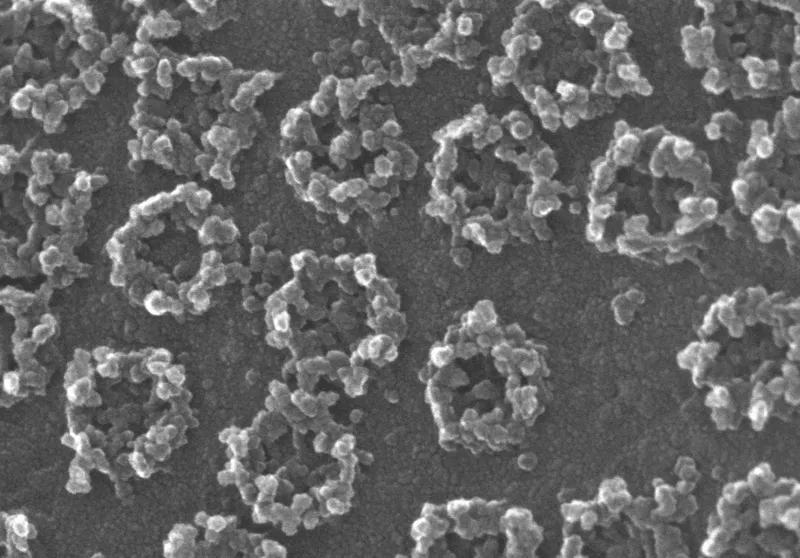 electron micrograph of nuclear pores