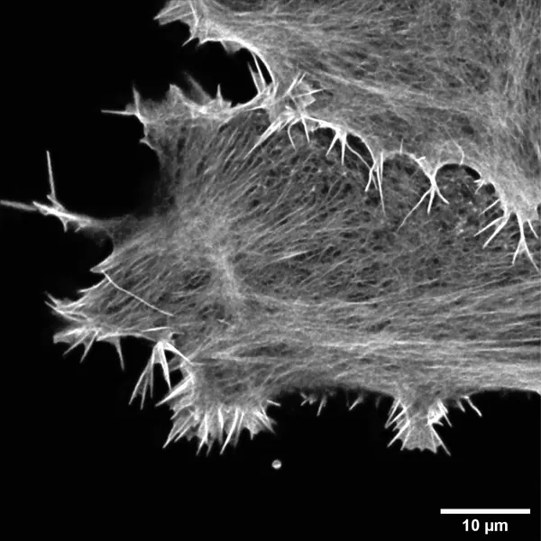 New super bright probes for actin