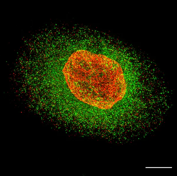 VectorLabs Photo competition winner. Nuclear envelope staining of breast epithelia.