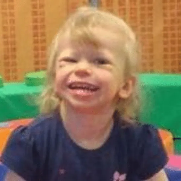 A child with Williams Syndrome