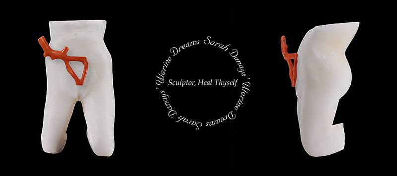 Front view and side view of a sculpture in white stone of a female nude torso, a piece of red coral is placed on the front where the uterus would sit in the centre is writing in a circle saying Uterine Dreams: sculptor heal thyself Sarah Danays
