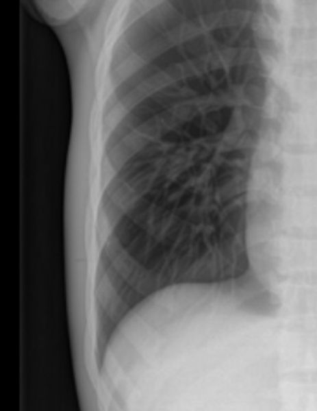 x-ray image of chests
