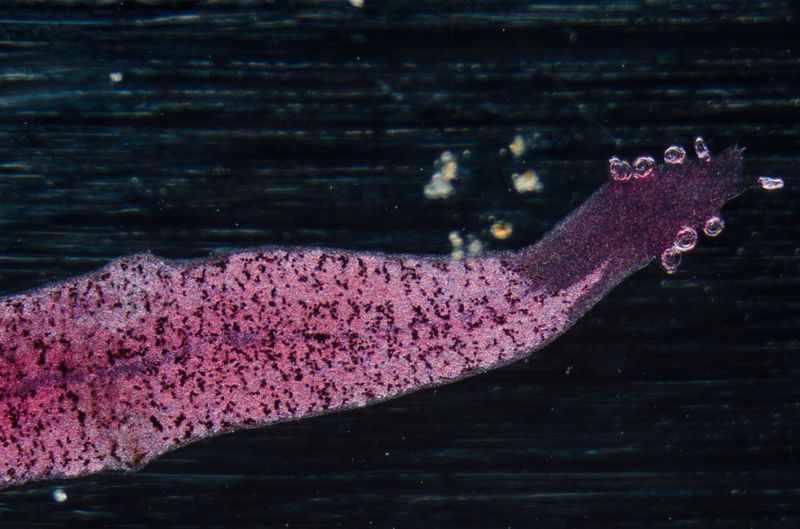 iStock image of a hookworm