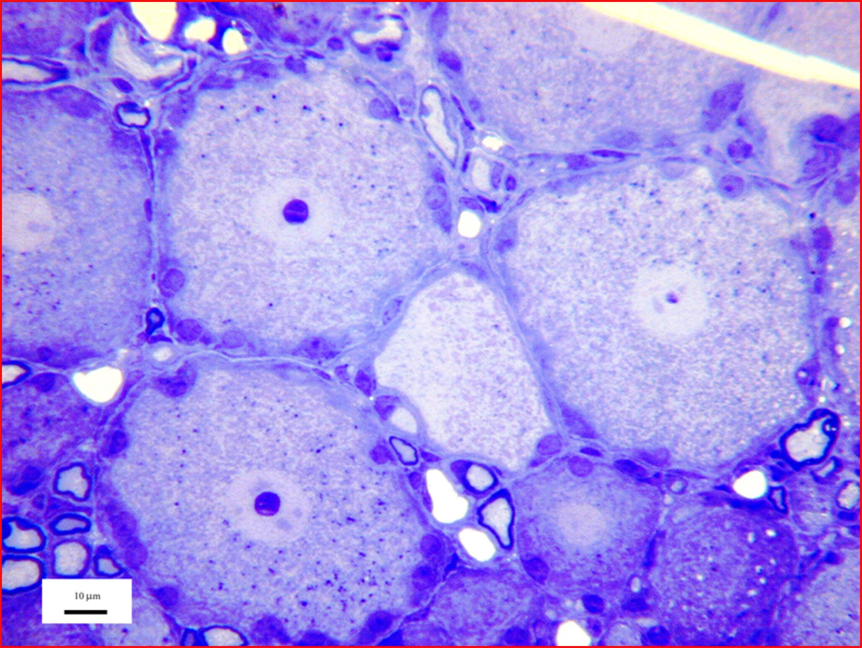 Microscopy image of Sensory nerve cells, courtesy of Dr R W Banks.