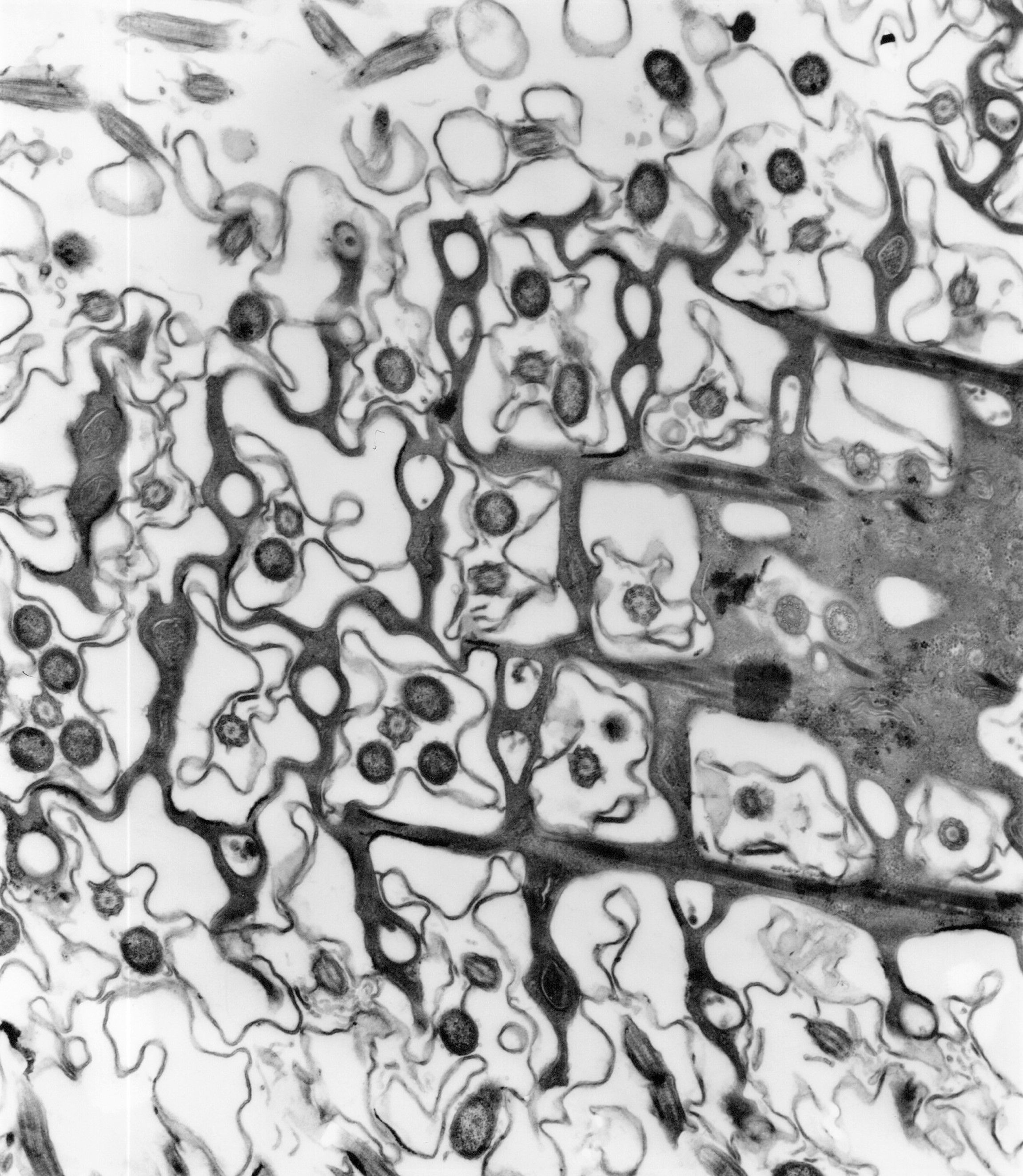 Electron microscope image of Paramecium, courtesy of Dr R W Banks.